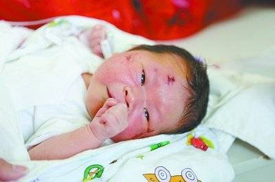 赵平安（厦门车祸中出生的奇迹宝宝）