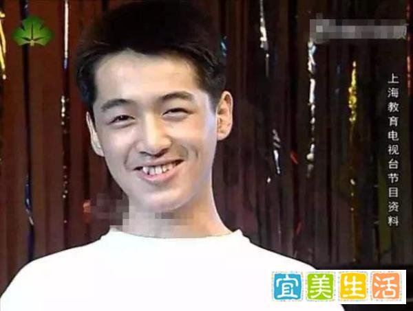 明星整牙堪比整容，高圆圆笑得好看全靠牙，蔡徐坤胡歌似变了个人