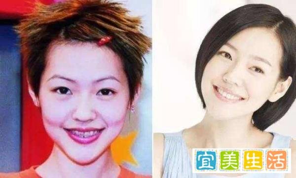 明星整牙堪比整容，高圆圆笑得好看全靠牙，蔡徐坤胡歌似变了个人