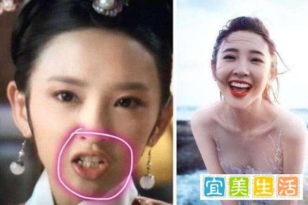 明星整牙堪比整容，高圆圆笑得好看全靠牙，蔡徐坤胡歌似变了个人