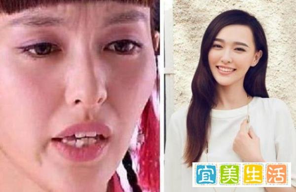 明星整牙堪比整容，高圆圆笑得好看全靠牙，蔡徐坤胡歌似变了个人