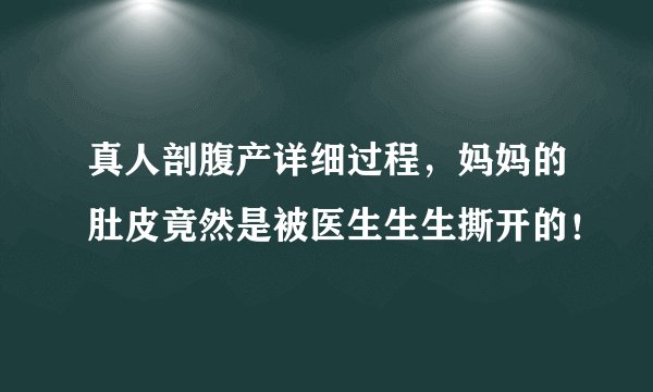 真人剖腹产详细过程，妈妈的肚皮竟然是被医生生生撕开的！