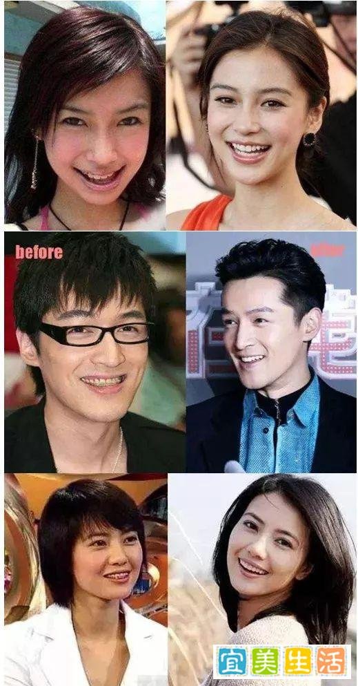 为什么有些人笑起来很好看？如何才能有“微笑曲线”？