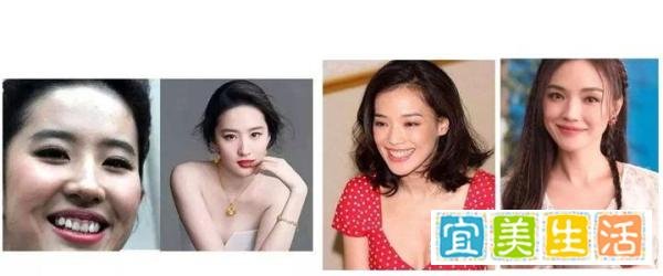 为什么有些人笑起来很好看？如何才能有“微笑曲线”？