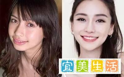 明星整牙堪比整容，高圆圆笑得好看全靠牙，蔡徐坤胡歌似变了个人
