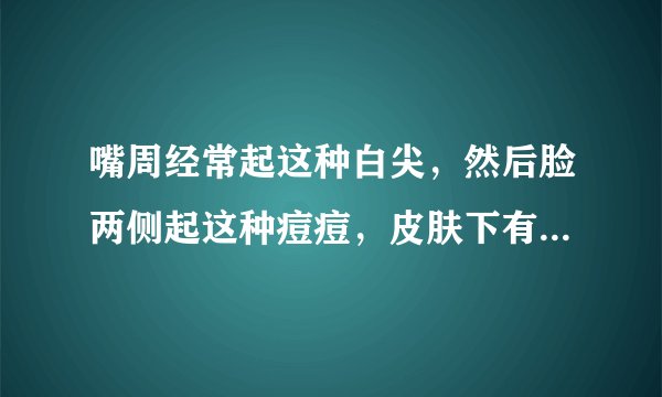 嘴周经常起这种白尖，然后脸两侧起这种痘痘，皮肤下有硬块，有的硬块疼