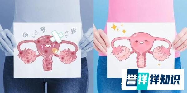 女子连续3年每月痛经15天，竟然是“罕见病”在作怪！