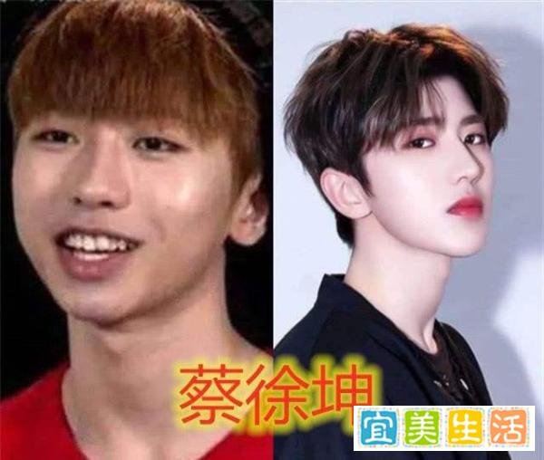 明星整牙堪比整容，高圆圆笑得好看全靠牙，蔡徐坤胡歌似变了个人