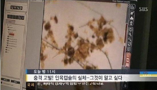 人肉胶囊的介绍