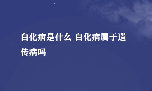 白化病是什么 白化病属于遗传病吗