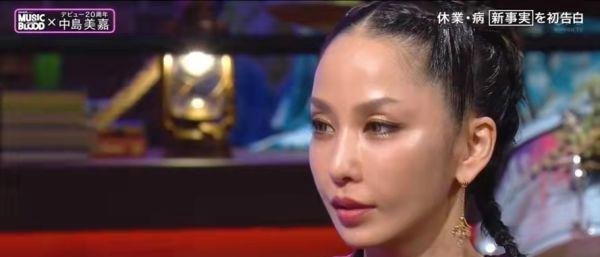 不向命运低头,日本天后中岛美嘉恢复听力,再唱经典歌曲