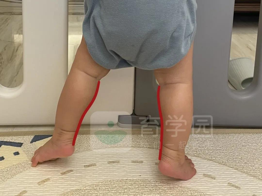 宝宝腿再抬高一点