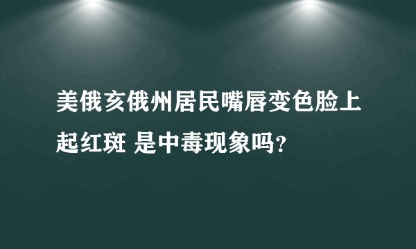 美俄亥俄州居民嘴唇变色脸上起红斑 是中毒现象吗？